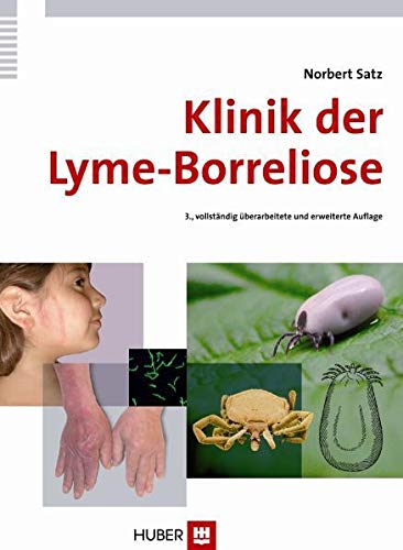Klinik der Lyme-Borreliose - Satz, Norbert
