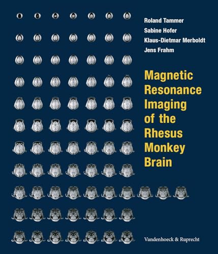 Magnetic Resonance Imaging of the Rhesus Monkey Brain.