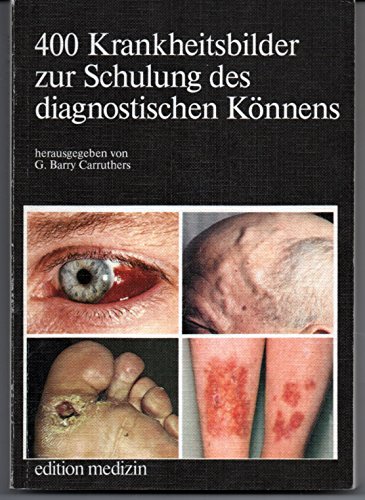 Beispielbild fr 400 Krankheitsbilder zur Schulung des diagnostischen Knnens. zum Verkauf von Steamhead Records & Books