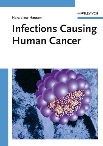 Stock image for Infections Causing Human Cancer for sale by Wizard Books