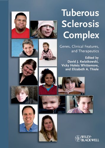 Beispielbild fr Tuberous Sclerosis Complex: Genes, Clinical Features and Therapeutics zum Verkauf von SecondSale