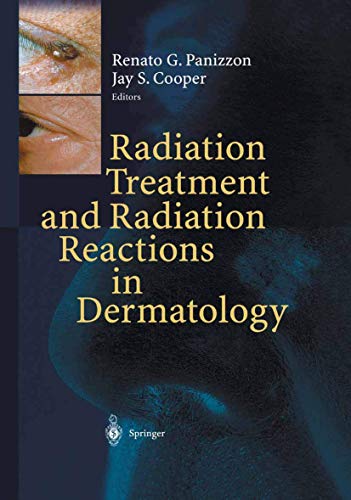9783540003458: Radiation Treatment and Radiation Reactions in Dermatology