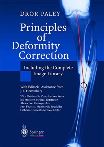 Beispielbild fr Principles Of Deformity Correction zum Verkauf von Romtrade Corp.