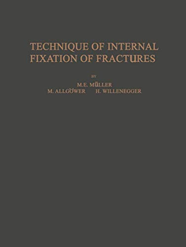 Technique of Internal Fixation of Fractures (9783540033745) by Maurice E. MÃ¼ller; Martin AllgÃ¶wer; W. Bandi; H.R. Bloch; A. Mumenthaler; R. Schneider; F. Straumann; Bernhard G. Weber; Hans Willenegger; S....