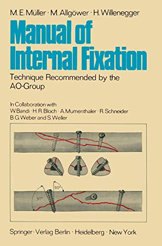 Imagen de archivo de Manual of Internal Fixation: Technique Recommended by the AO-Group Swiss Association for the Study of Internal Fixation: ASIF a la venta por HPB-Red