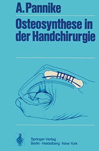 Beispielbild fr Osteosynthese in der Handchirurgie. zum Verkauf von Bojara & Bojara-Kellinghaus OHG