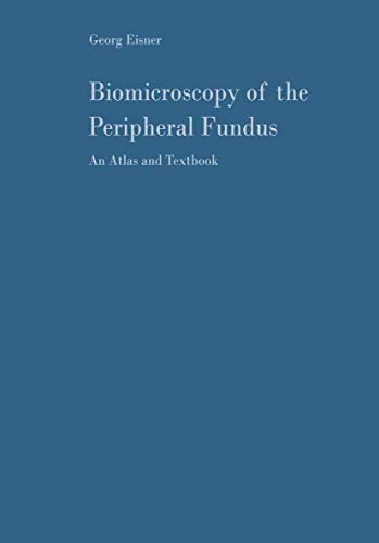 Imagen de archivo de Biomicroscopy of the Peripheral Fundus: An Atlas and Textbook a la venta por Basi6 International