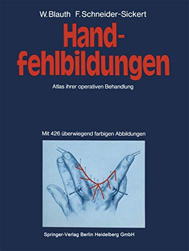 9783540077800: Handfehlbildungen: Atlas ihrer operativen Behandlung