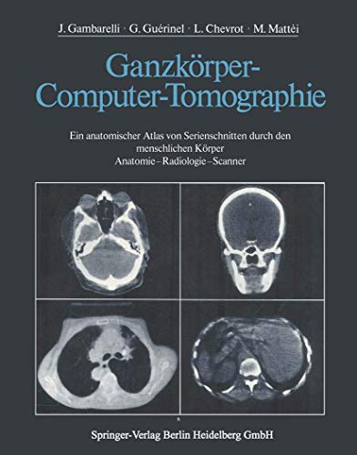 Stock image for Ganzkrper-Computer-Tomographie. Ein anatomischer Atlas von Serienschnitten durch den menschlichen Krper. Anatomie - Radiologie - Scanner. Unter Mitwirkung von R. Galliano und S. Nazarian. Zeichnungen von J. P. Jacomy. Photographien von D. Amy und M. Soler. for sale by Antiquariat am St. Vith