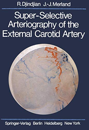 Super-selective arteriography of the external carotid artery. - Djindjian, René and Jean-Jacques Merland