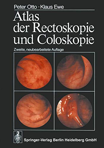 Atlas der Rectoskopie und Coloskopie.