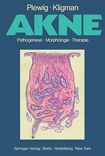 Beispielbild fr Akne. Pathogenese, Morphologie, Therapie zum Verkauf von medimops