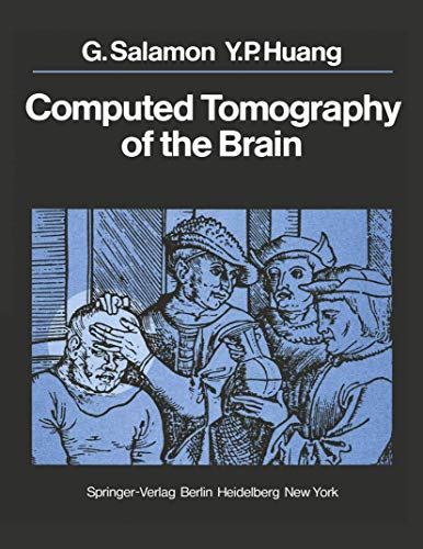 9783540088257: Computed Tomography of the Brain: Atlas of Normal Anatomy
