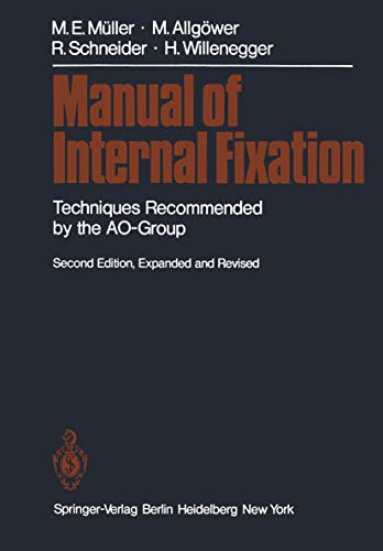 Imagen de archivo de Manual of Internal Fixation a la venta por Better World Books