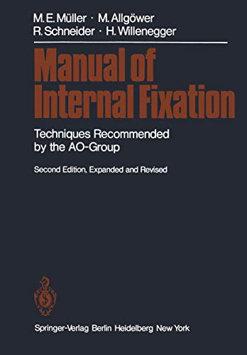 Stock image for Manual of Internal Fixation for sale by Better World Books