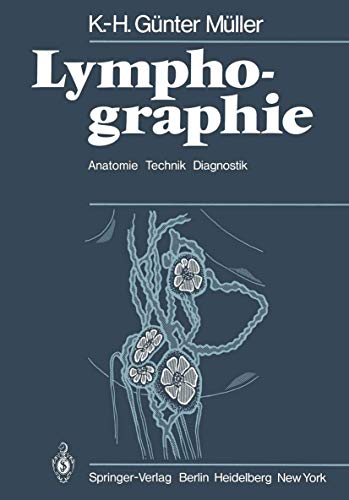 9783540092612: Lymphographie: Anatomie Technik Diagnostik (German Edition)