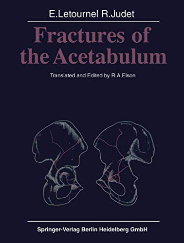 9783540098751: Fractures of the Acetabulum