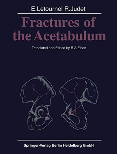 Fractures of the Acetabulum (9783540098751) by Emile Letournel; Robert Judet