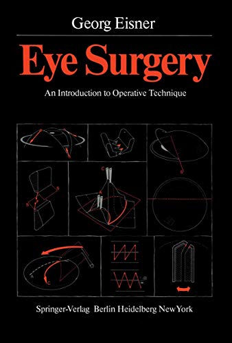 Eye Surgery: An Introduction to Operative Technique (9783540099222) by Peter Schneider