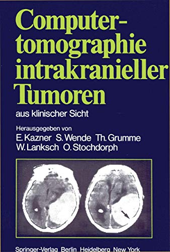 9783540105404: Computertomographie intrakranieller Tumoren aus klinischer Sicht (German Edition)