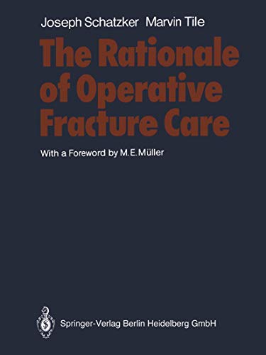 9783540106753: The Rationale of Operative Fracture Care