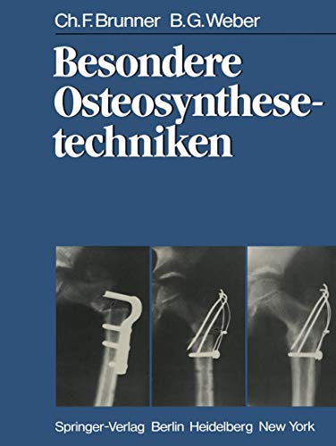 Besondere Osteosynthesetechniken