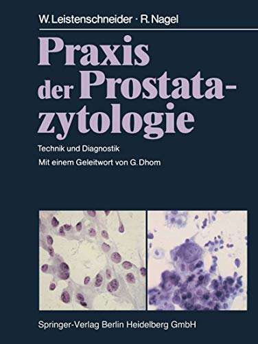 9783540130833: Praxis der Prostatazytologie: Technik und Diagnostik