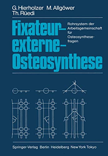9783540135197: Fixateur-externe-Osteosynthese: Rohrsystem der Arbeitsgemeinschaft fr Osteosynthesefragen