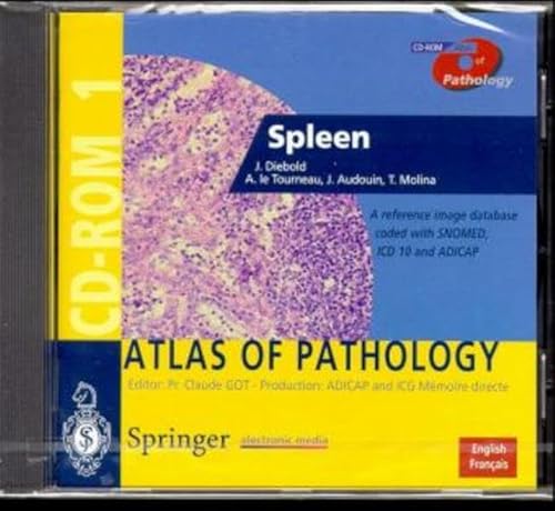 Spleen (CD-ROM Atlas of Pathology) (9783540146407) by Jacques Diebold; A. Le Tourneau; J. Audouin; T. Molina