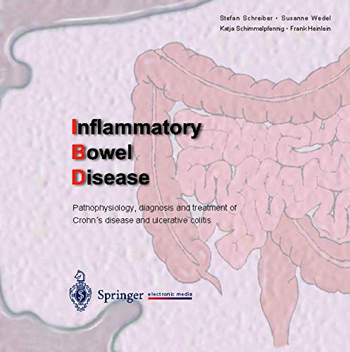 Stock image for Inflammatory Bowel Disease for sale by Books Puddle