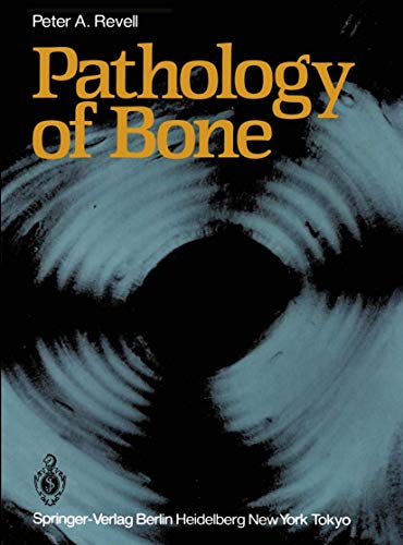 9783540154181: Pathology of Bone