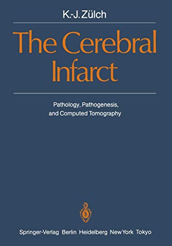 The Cerebral Infarct. Pathology, Pathogenesis, and Computed Tomography