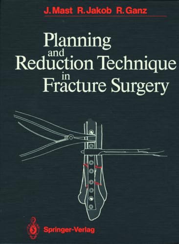 9783540162834: Planning and Reduction Technique in Fracture Surgery