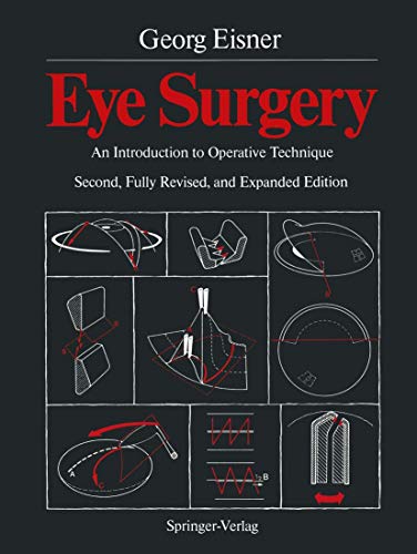 9783540174073: Eye Surgery: An Introduction to Operative Technique