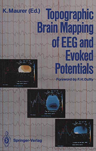 Beispielbild fr Topographic Brain Mapping of EEG and Evoked Potentials zum Verkauf von medimops