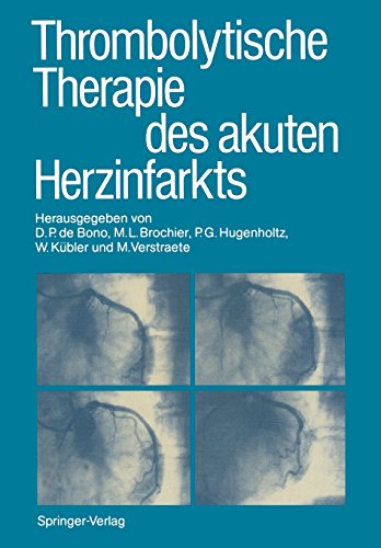 Stock image for Thrombolytische Therapie des akuten Herzinfarkts - guter Zustand for sale by Weisel