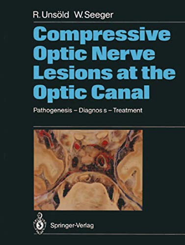 Compressive Optic Nerve Lesions at the Optic Canal: Pathogenesis â€“ Diagnosis â€“ Treatment (9783540188384) by Renate UnsÃ¶ld; Wolfgang Seeger