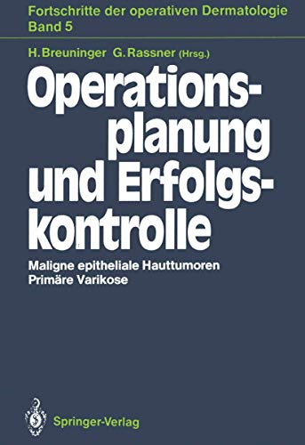 Stock image for Operationsplanung und Erfolgskontrolle for sale by Ria Christie Collections