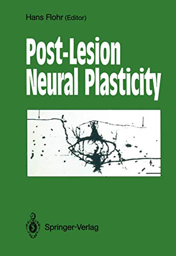 Stock image for Post-Lesion Neural Plasticity for sale by Antiquariat am Roacker