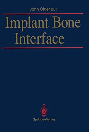 Beispielbild fr Implant Bone Interface zum Verkauf von Buchpark