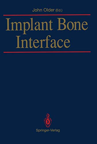 9783540196389: Implant Bone Interface
