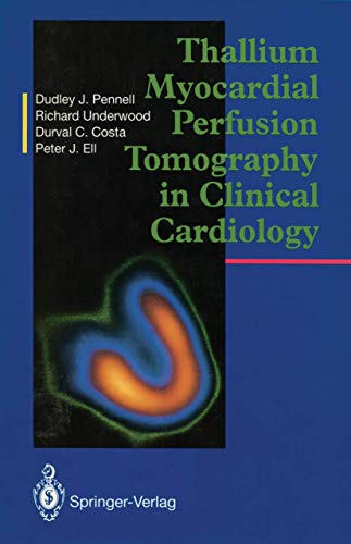 Stock image for Thallium Myocardial Perfusion Tomography in Clinical Cardiology for sale by Martin Preu / Akademische Buchhandlung Woetzel