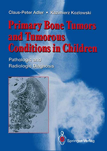 9783540197317: Primary Bone Tumors and Tumorous Conditions in Children: Pathologic and Radiologic Diagnosis