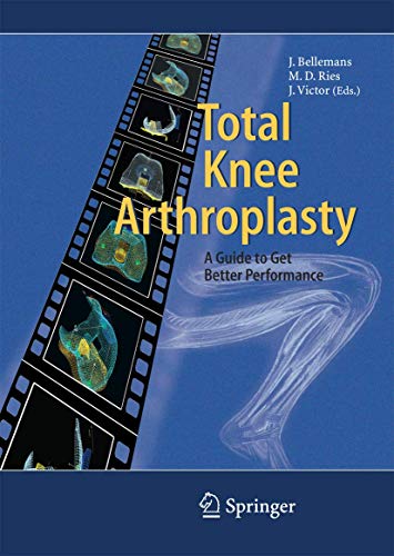 Beispielbild fr Total Knee Arthroplasty zum Verkauf von St Vincent de Paul of Lane County