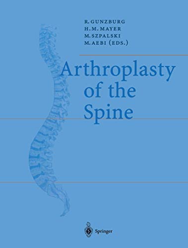 Beispielbild fr Arthroplasty Of The Spine zum Verkauf von Basi6 International