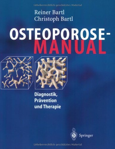 Stock image for Osteoporose-Manual. Diagnostik, Prvention und Therapie. for sale by Nicoline Thieme