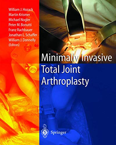 9783540210078: Minimally Invasive Total Joint Arthroplasty