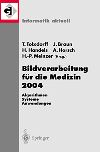 9783540210597: Bildverarbeitung Fur Die Medizin 2004: Algorithmen - Systeme - Anwendungen (Informatik aktuell)