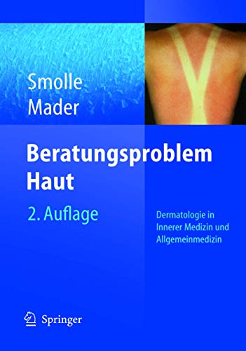 Beispielbild fr Beratungsproblem Haut: Diagnostik, Therapie und Pflege im Praxisalltag zum Verkauf von medimops