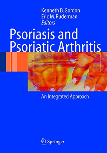 Psoriasis And Psoriatic Arthritis: An Integrated Approach